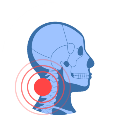 Neck-Pain-Treatment-2