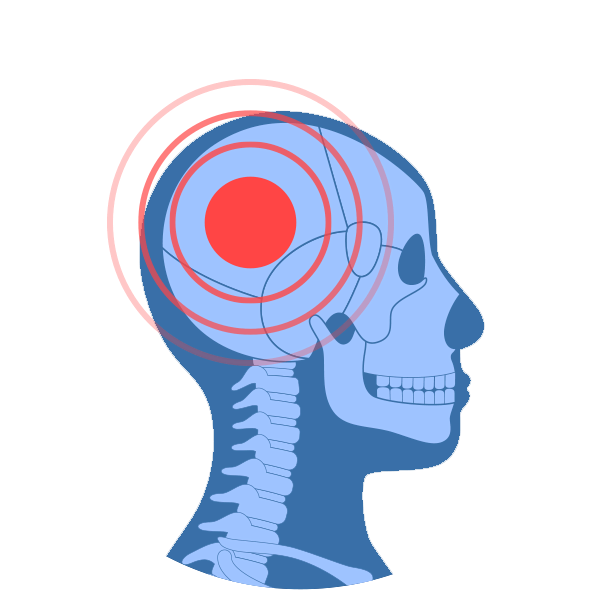 head-pain-treatment