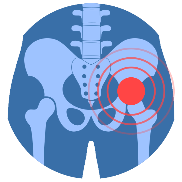 hip-pain-treatment