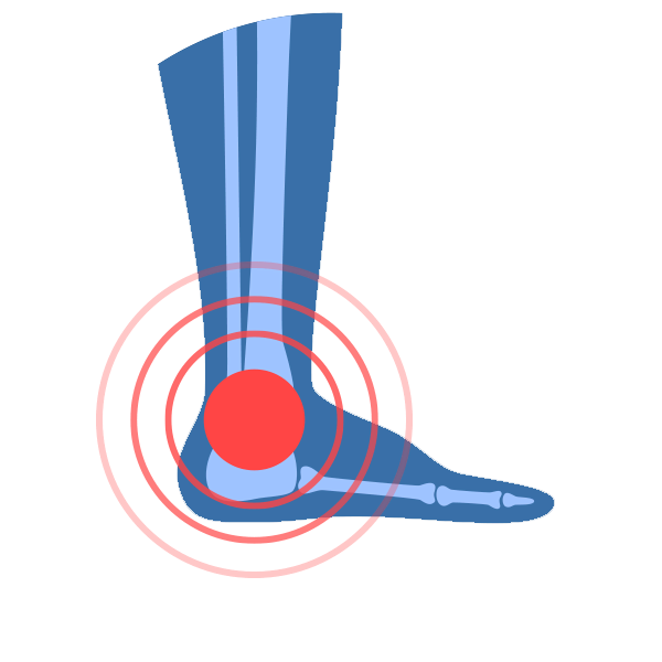 joint-pain-treatment