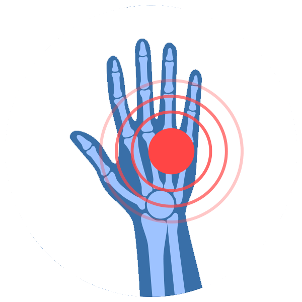 nerve-pain-treatment