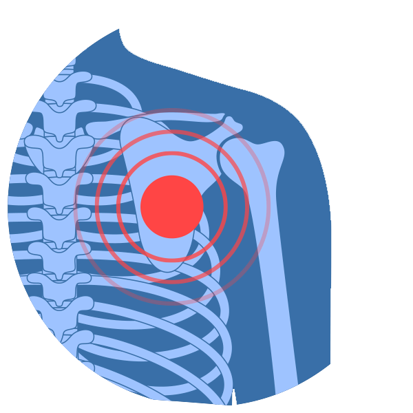 shoulder-pain-treatment